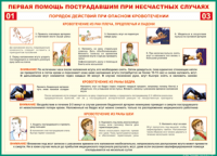 Таблица "Порядок действий при опасном кровотечении" (100х140 сантиметров, винил) - fgospostavki.ru - Кубинка