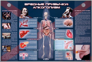 Электрифицированный стенд "Вредные привычки: алкоголизм" - fgospostavki.ru - Кубинка